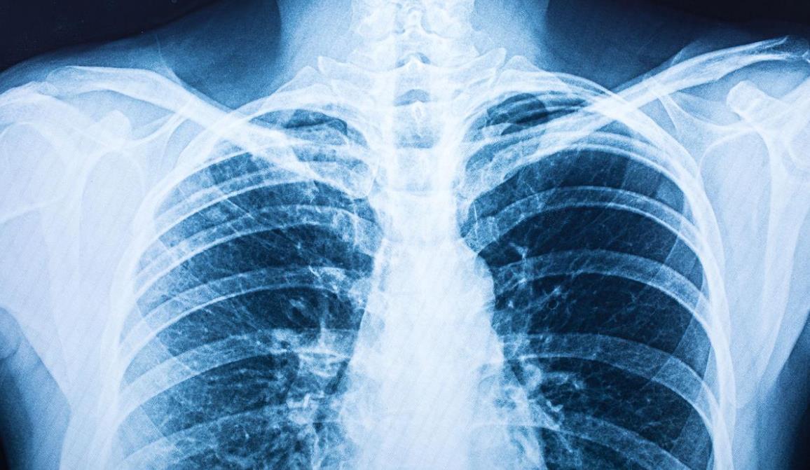 Proper understanding of X-rays